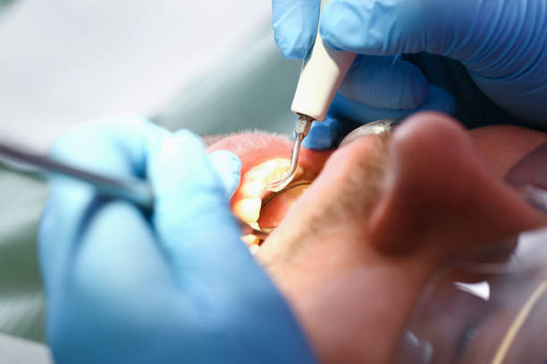 Best Emergency Dental Extractions in Morganville, NJ