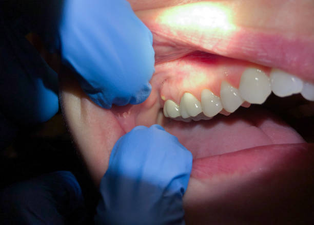 Best Pediatric Emergency Dentist in Morganville, NJ